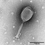 Enterobacteria_phage_T2_transmission_electron_micrograph.jpg